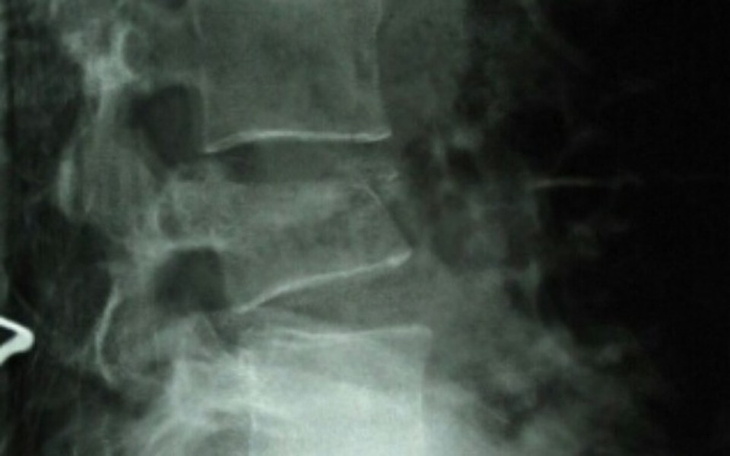 Zbiórka Na operację liczy się każda minu - zdjęcie główne