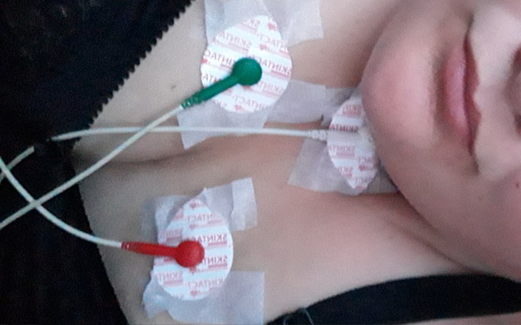 Elektrody na ciele osoby, przygotowanie do badania.