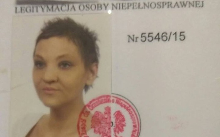 Zbiórka Rehabilitacja, leczenie Anity - zdjęcie główne