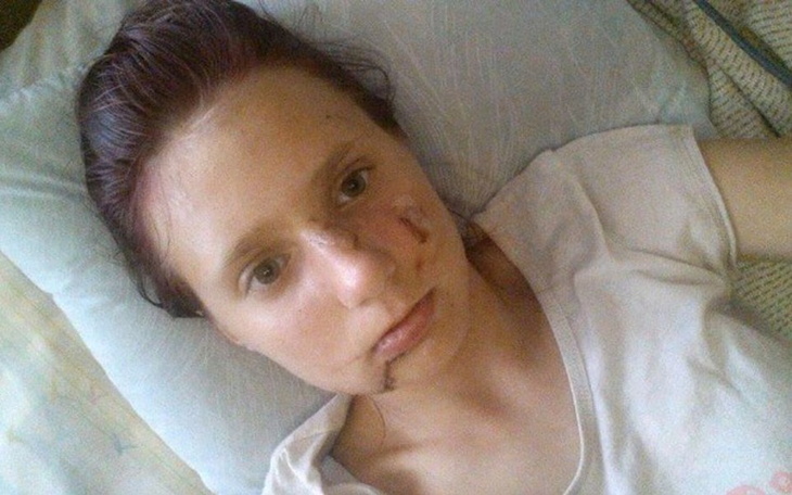 Zbiórka na leczenie. - zdjęcie główne