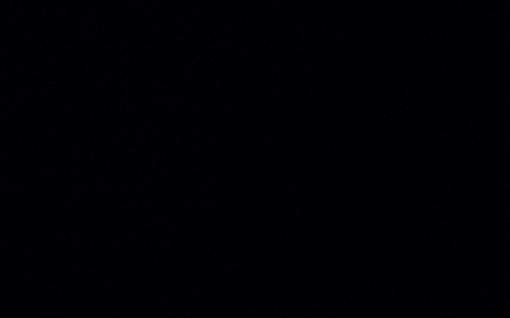 Zbiórka Zbieram na leczenie mojego uzębi - zdjęcie główne