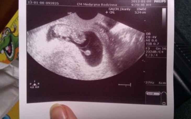 Zbiórka Poczatkowy start samotnej mamy - zdjęcie główne