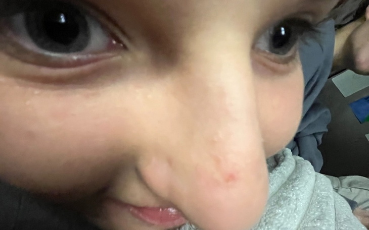 Zbiórka dla mlodej panny - zdjęcie główne