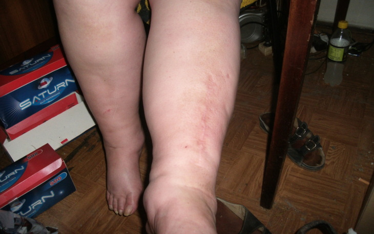 Zbiórka na zadłóżene mieszlania - zdjęcie główne