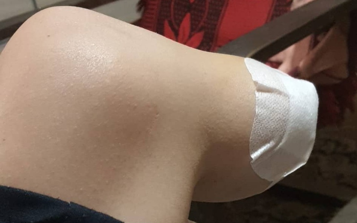 Zbiórka Na rehabilitacje i proteze - zdjęcie główne