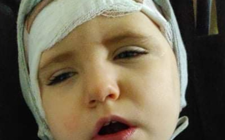 Zbiórka Rehabilitacja i leczenie Olka - zdjęcie główne