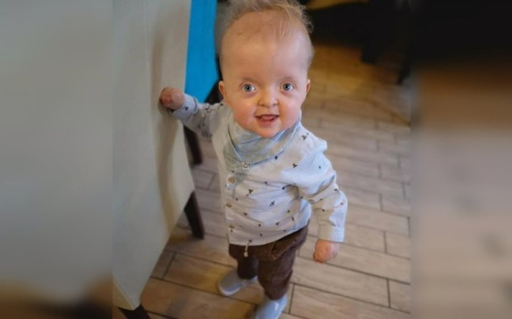 Zbiórka Biegam kilometr dla uśmiechu - zdjęcie główne