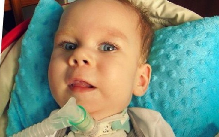 Zbiórka Zbiórka na rehabilitację Kubusia - zdjęcie główne