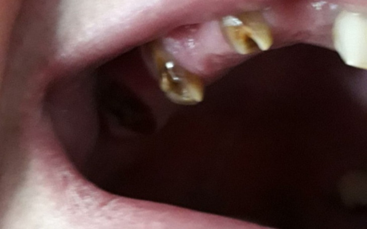 Zbiórka Pomóc osobie nie pewnosprawnej - zdjęcie główne