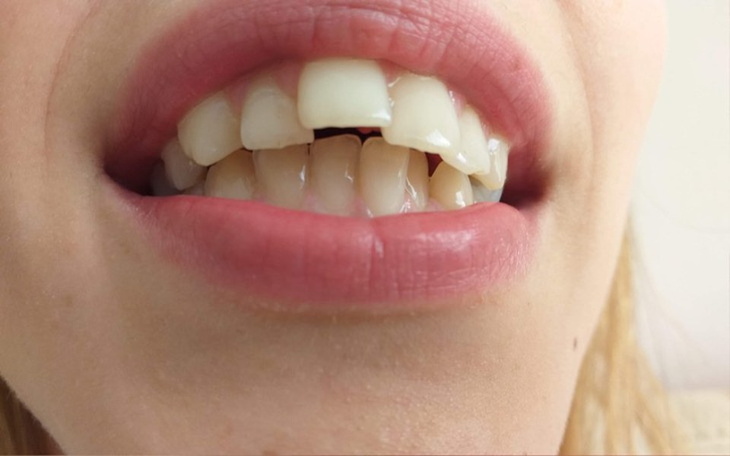 Zbiórka Zbieram na naprawę zębów - zdjęcie główne