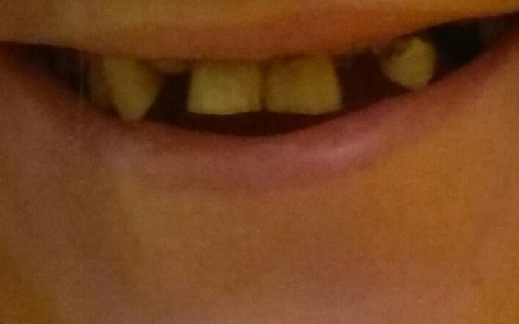 Zbiórka Zbieram na nowy piękny uśmiech - zdjęcie główne