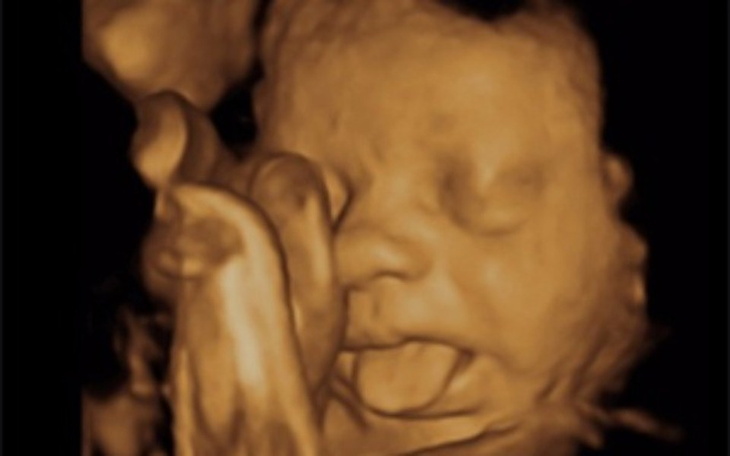 Zbiórka s - zdjęcie główne