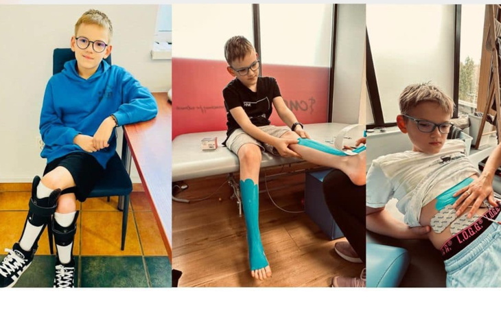 Chłopiec w niebieskiej bluzie z unieruchomioną nogą.