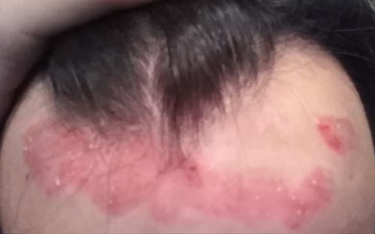 Zbiórka Na wyjazd leczniczy - zdjęcie główne