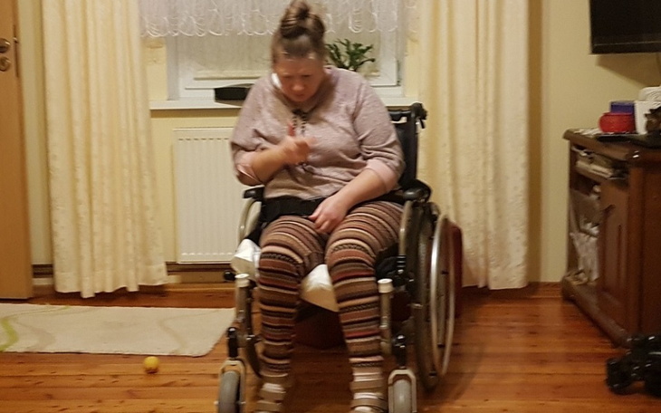 Zbiórka Dla Ani - pomoc w rehabilitacji - zdjęcie główne