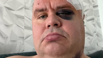 Zbiórka Pomóż Wojciechowi Szumotalskiemu - miniaturka zdjęcia