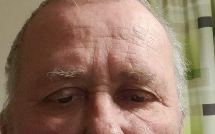 Zbiórka Na operację cierpiącego - zdjęcie główne