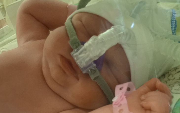 Zbiórka Dla Agatki na rehabilitacja - zdjęcie główne