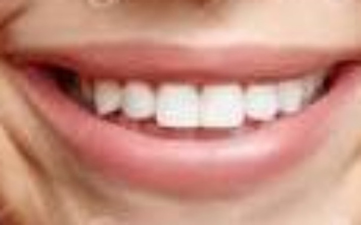 Zbiórka Piękne białe zęby - zdjęcie główne