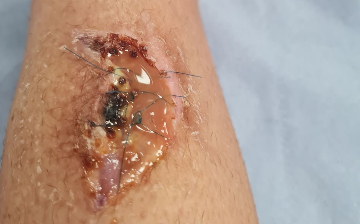 Zbiórka Leczenie w Kolonii w Niemczech - zdjęcie główne