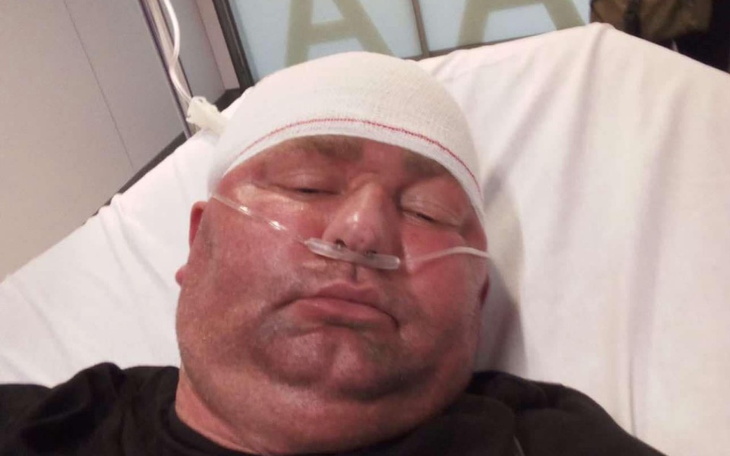 Mężczyzna leżący w szpitalu z opatrunkiem na głowie.