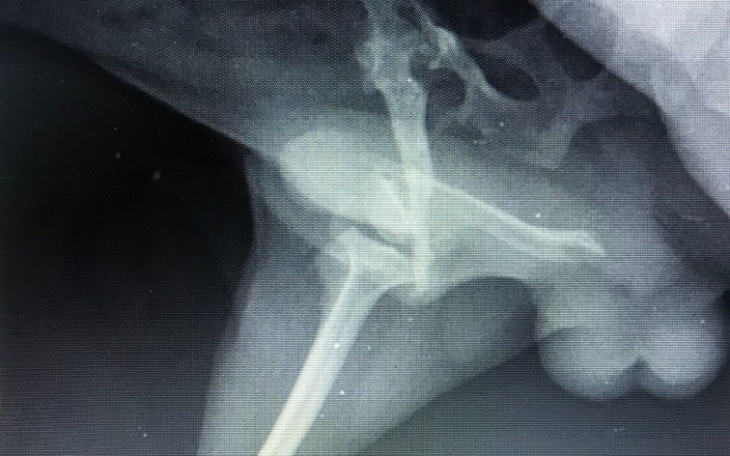 Zbiórka Benek walczy ze starym urazem - zdjęcie główne