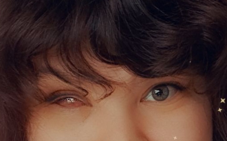 Zbiórka Proteza oka i dalsze leczenie - zdjęcie główne