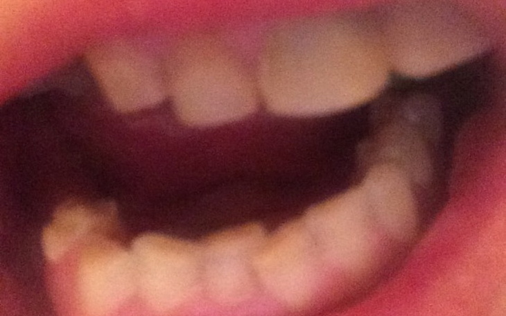 Zbiórka Nowy usmiech nowe zeby - zdjęcie główne