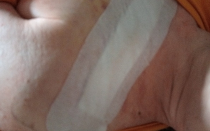 Zbiórka Na leki i na leczenie dla żony - zdjęcie główne