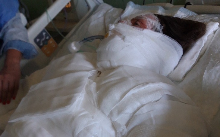 Osoba w szpitalu, owinięta bandażami, leżąca na łóżku.