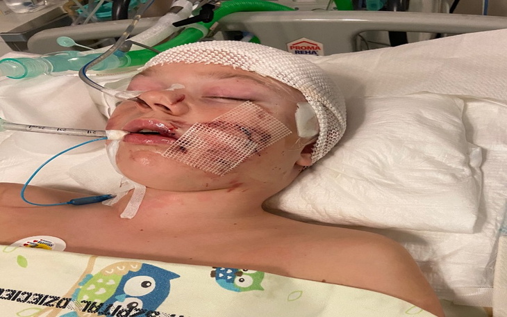 Zbiórka Rehabilitacja Leonarda - zdjęcie główne