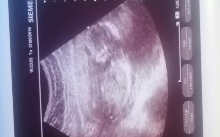 Zbiórka Pomoc dla nastolatki w ciąży. - zdjęcie główne