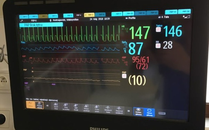 Zbiórka Monitor funkcji życiowych- ICZMP - zdjęcie główne