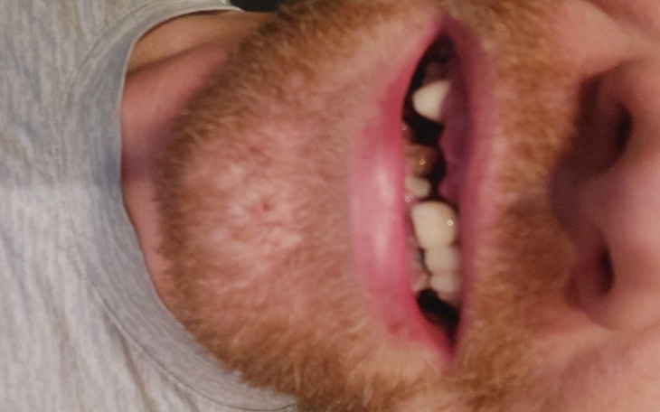 Zbiórka Proteza zębowa - Wesele - zdjęcie główne