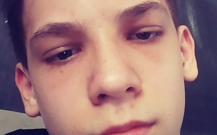 Zbiórka Pomagan i walcz z porażeniemmózg - zdjęcie główne