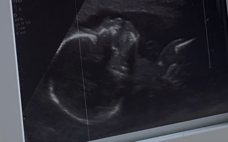 Zbiórka Wyprawka noworodkowa - zdjęcie główne