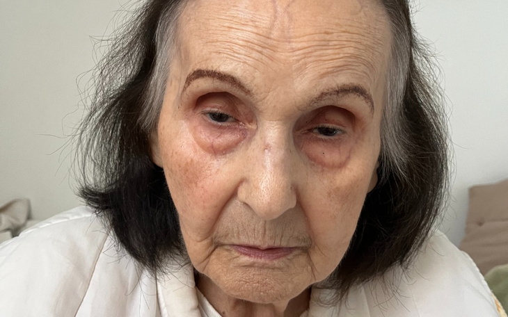 Zbiórka Leczenie rehabilitacja lekarstwa - zdjęcie główne