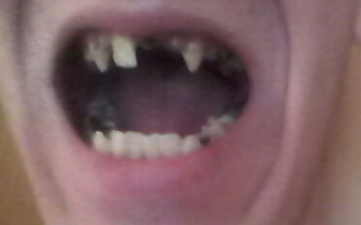 Zbiórka Na leczenie paradontozy - zdjęcie główne