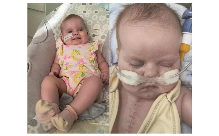 Dziecko w uśmiechającym się stroju, z rurką tlenową, pokazujące siłę.