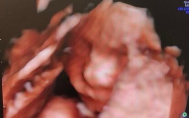 Zbiórka Wyprawka dla małej Ninki - zdjęcie główne