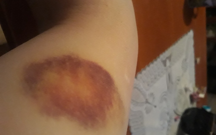 Zbiórka Nie daje już rady - zdjęcie główne