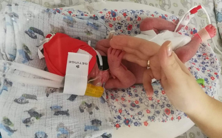 Noworodek w inkubatorze, otoczony opieką medyczną.