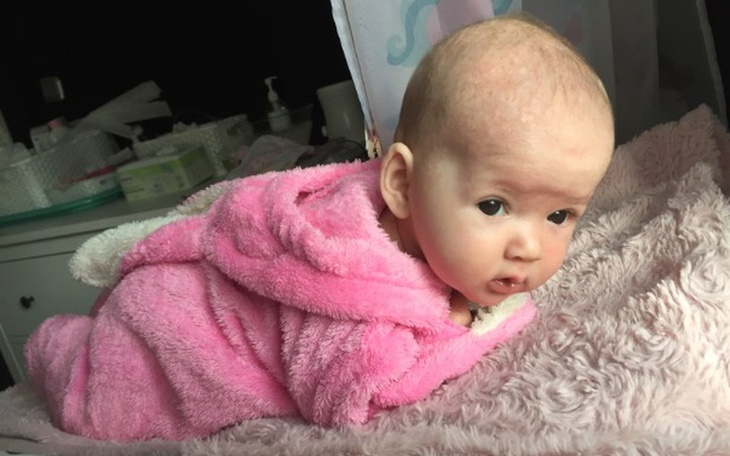 Zbiórka Pilna  pomoc dla Mii z rkiw! - zdjęcie główne