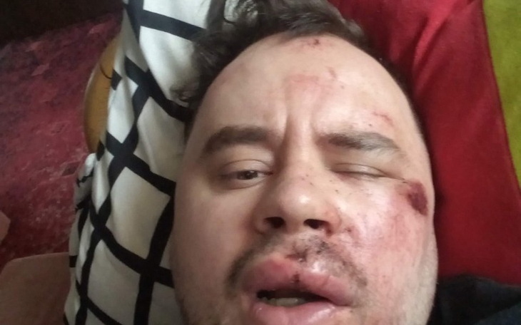 Zbiórka Na Życie po pobiciu - zdjęcie główne