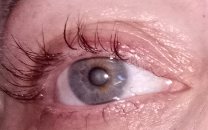 Zbiórka Na diagnostykę, dojazdy i koszty - zdjęcie główne