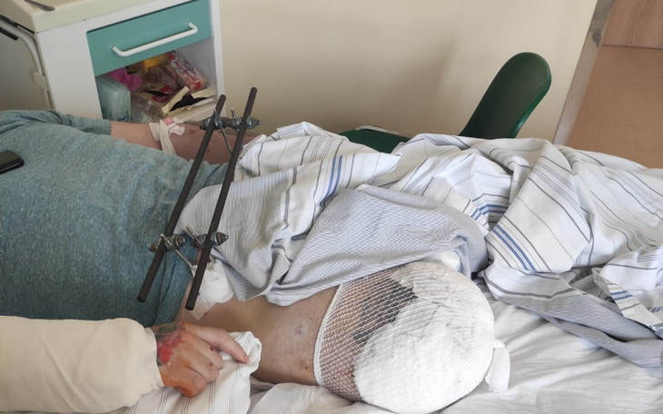 Zbiórka Dla brata na protezę nogi - zdjęcie główne