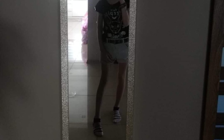 Zbiórka Anoreksja turnus w Malawie - zdjęcie główne