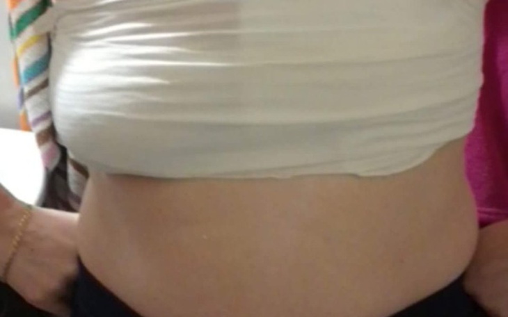 Zbiórka Leczenie raka piersi i węzłów ch - zdjęcie główne