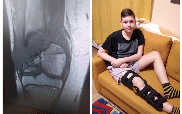 Zbiórka Rower inwalidzki typu handbike - zdjęcie główne