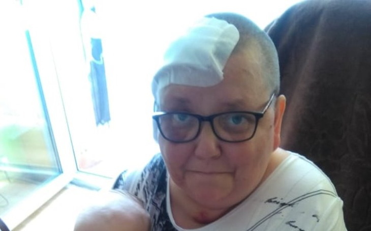 Zbiórka ELIZA - walczy z nowotworem - zdjęcie główne